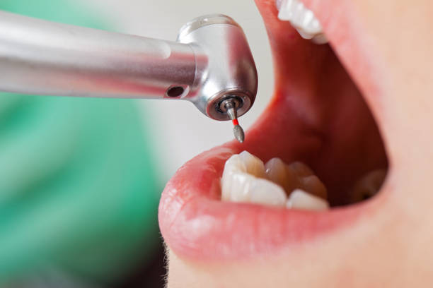 Best Emergency Dental Care for Broken or Chipped Teeth in Dike, IA